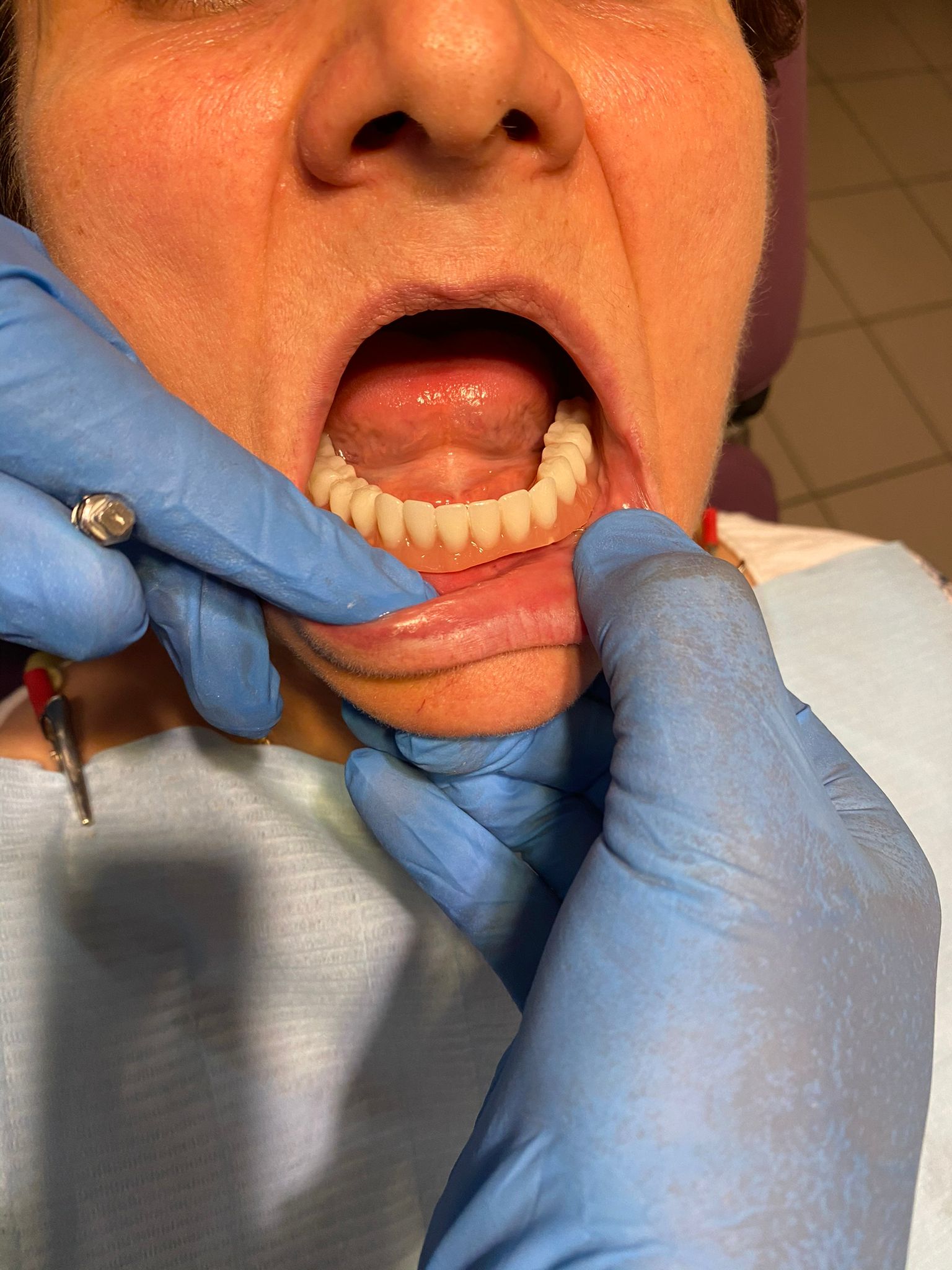 Stoma Urgent implant dentar
