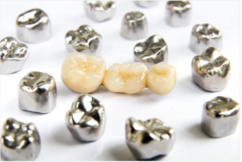 coroane-dentare-metalo-ceramice