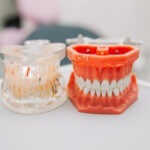 implant-dentar-sau-proteza-dentara
